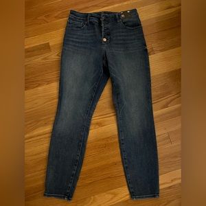Express “curvy” skinny jeans with 5 button detail.